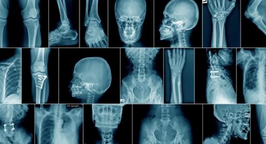 Sri Lanka faces shortage of 400 radiologists